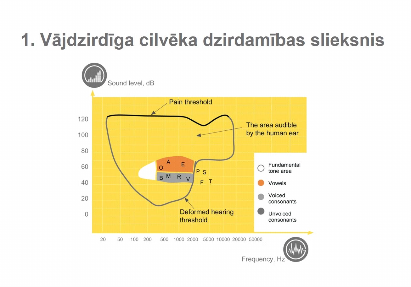 Vājdzirdība